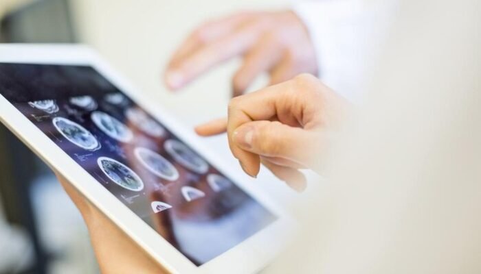 Dokter Imbau Hindari Makanan Berlebihan untuk Mencegah Risiko Otak ‘Rusak’