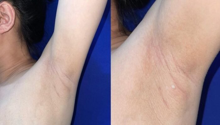 “Punya ‘Puting’ Tambahan, Wanita Ini Mengejutkan Dunia dengan ASI dari Ketiaknya!”