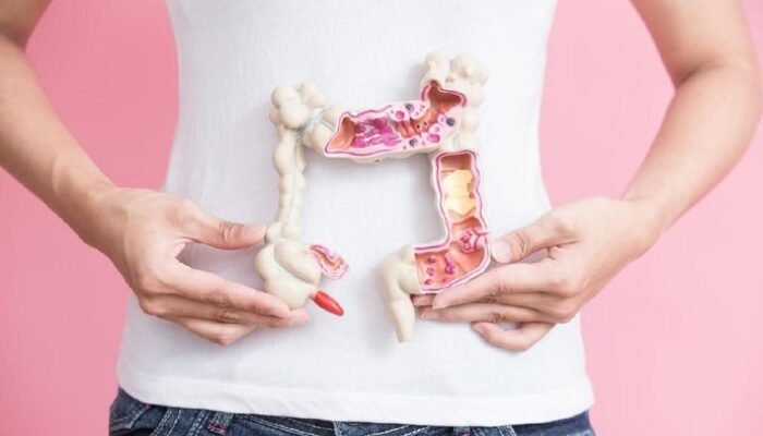 “Studi Harvard Ungkap Makanan Ini Picu Risiko Kanker Usus pada Wanita Muda”