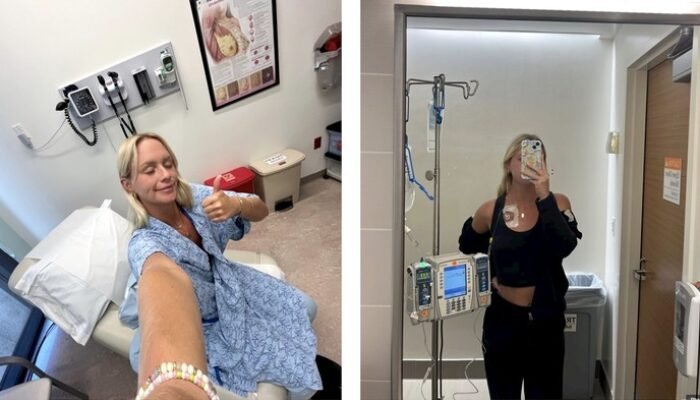 **Dari Usia 24 ke Menopause pada 25: Kisah Menegangkan Gen Z yang Idap Kanker Payudara**