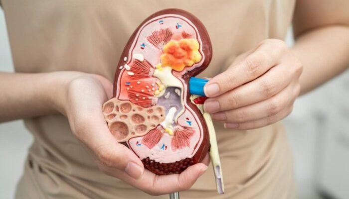 “Waspadai! Pakar AS Ungkap Kebiasaan Sederhana yang Memicu Kerusakan Ginjal pada Wanita Usia 40-an”