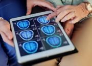 “Asupan yang Bisa Merusak Otak, Sering Dikonsumsi Warga +62: Kenali Risikonya Sebelum Terlambat!”