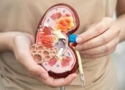 Dari Batu Ginjal hingga Amputasi Jari, Ini Kisah Mengerikan Wanita yang Perlu Dijadikan Pelajaran!