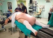 “Perut Pria Ini Membesar Tak Wajar, Ternyata Ada Tumor Sebesar 32 Kg: Fakta dan Pengaruhnya pada Kesehatan”