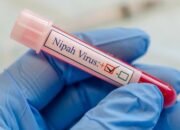Virus Nipah Menyerang India, Perawat Jadi Korban Fatal!