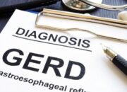 Jangan Disepelekan, Ini 5 Kebiasaan yang Bisa bikin GERD Muncul Kembali!