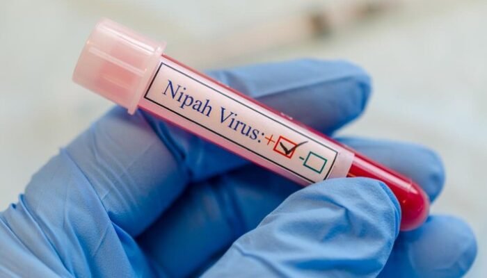 “Waspadai! Dokter Ungkap yang Terjadi pada Otak saat Terinfeksi Virus Nipah, Bisa Fatal”