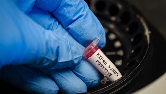 Pakar Ungkap Virus Nipah Pernah Ditemukan di Indonesia, Tapi pada Kelelawar - Update 1