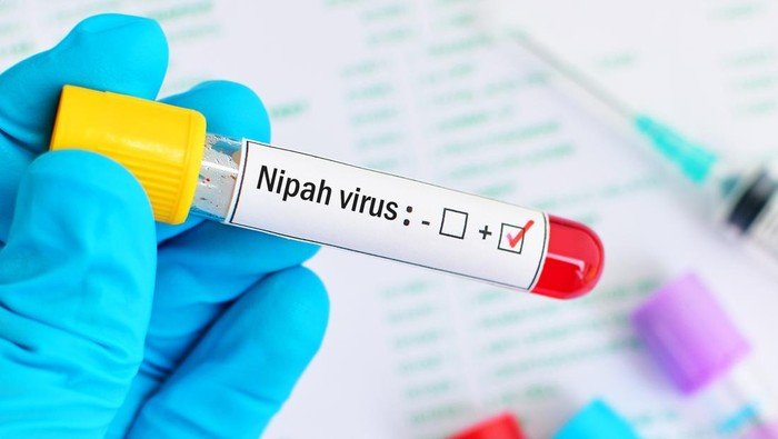 WHO Menilai Risiko Penyebaran Nipah dari India Masih Rendah