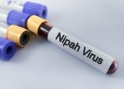 Waspada, Kemenkes RI Peringatkan Risiko Virus Nipah usai Mewabah di India!