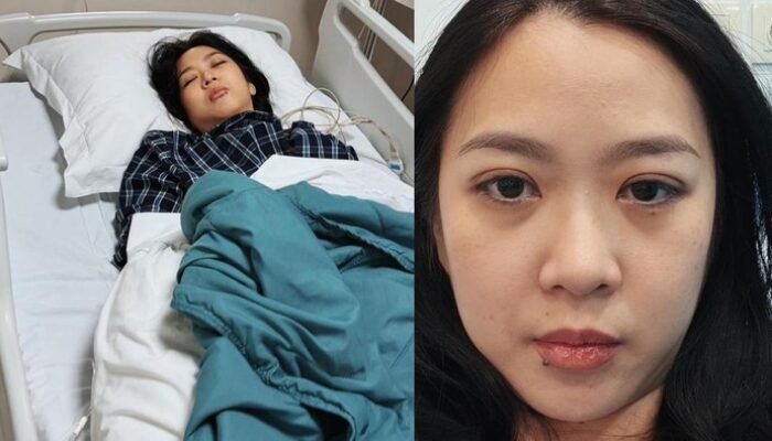 Fakta-fakta Wanita di Jaksel Kena Stroke di Usia 32 Tahun: Kenali Tanda-Tanda Awal