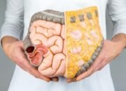 Makanan Ini Jadi Penyebab Utama Kanker Usus Besar pada Generasi Z