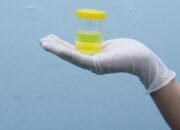 “Perhatikan Warna Urine Anda! Ini Tanda-Tanda Awal Ginjal Bercampur Infeksi”
