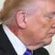 Red Mark on Trump’s Neck Ignites Health Speculation and Media Frenzy